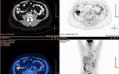 Comparing Mri And Ct Scans Risks And Indications