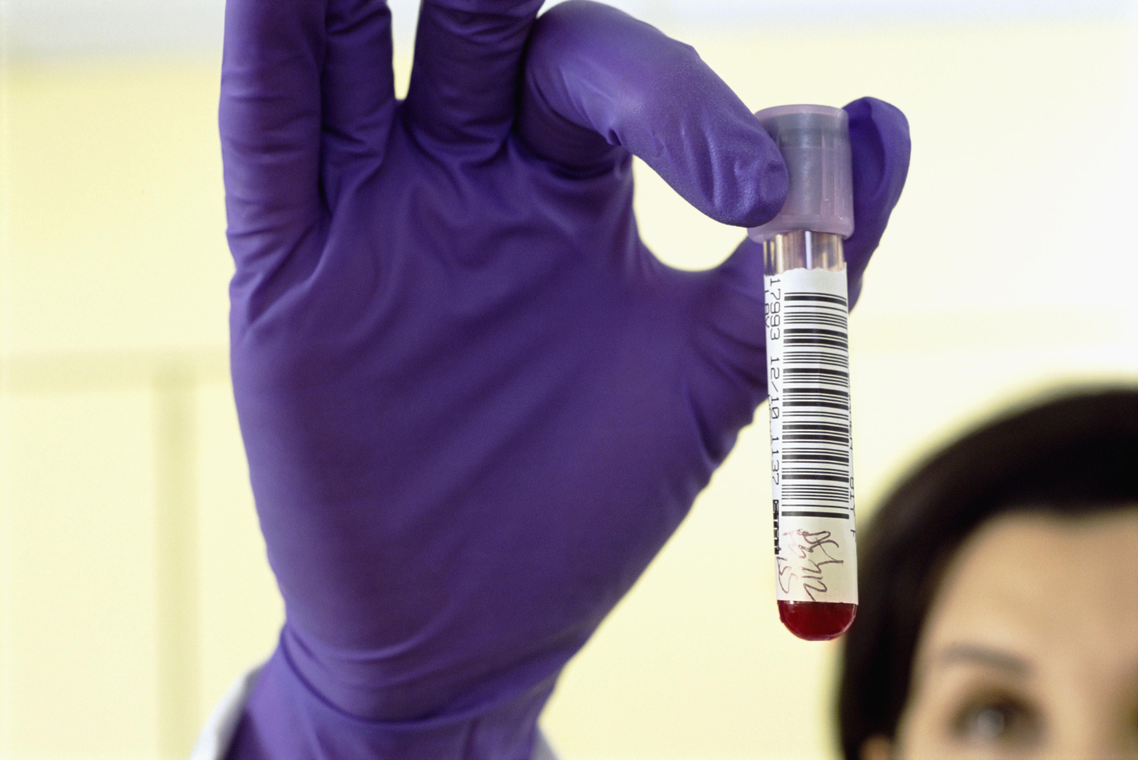 Day 3 FSH Levels Test For Fertility