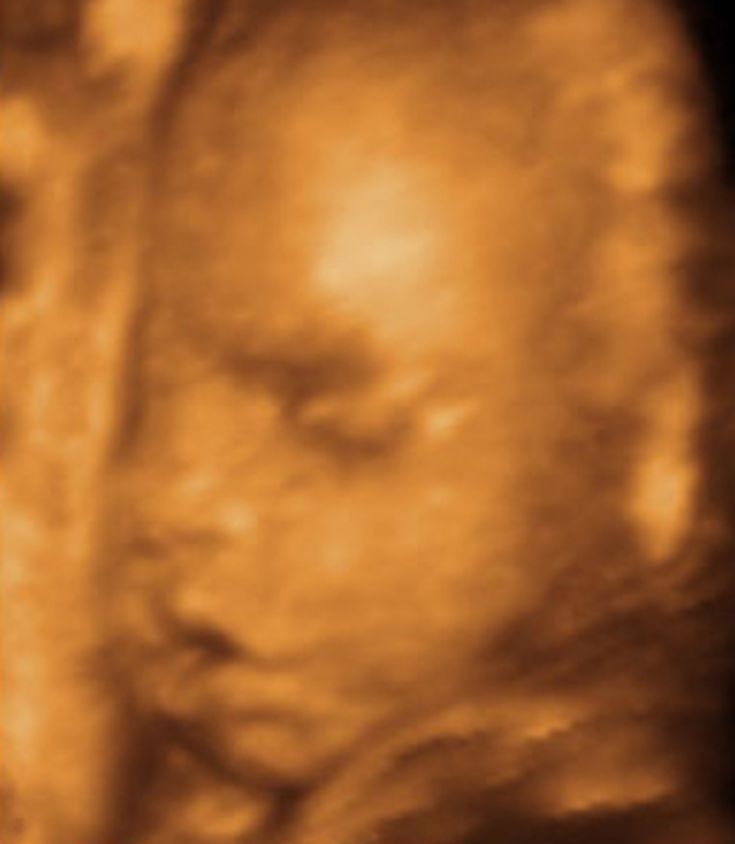 Фото малыша в 20 недель беременности