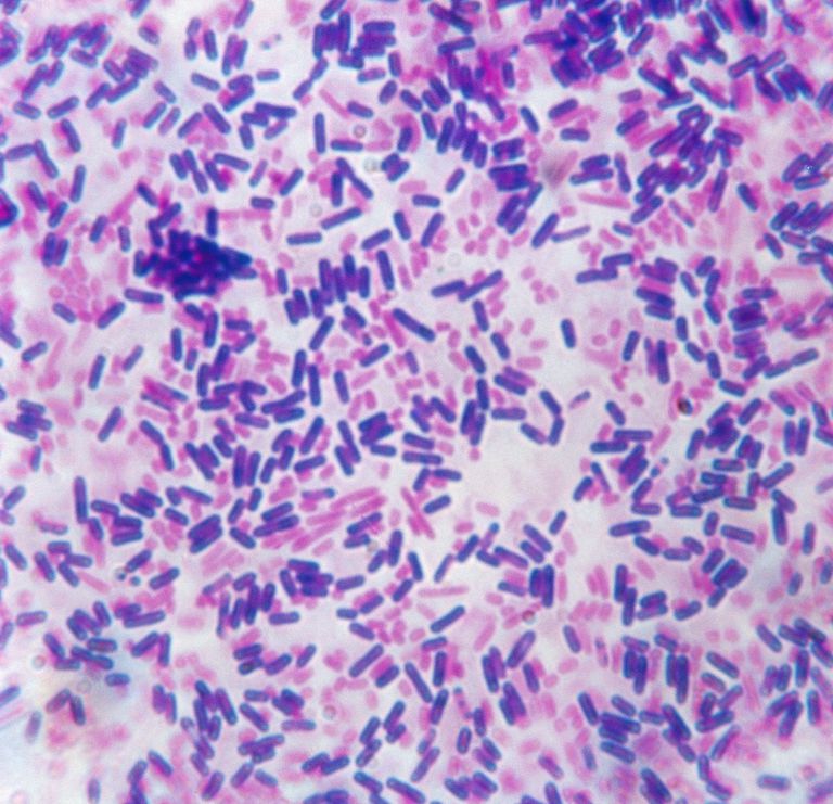 gram-negative-bacteria-dopqr