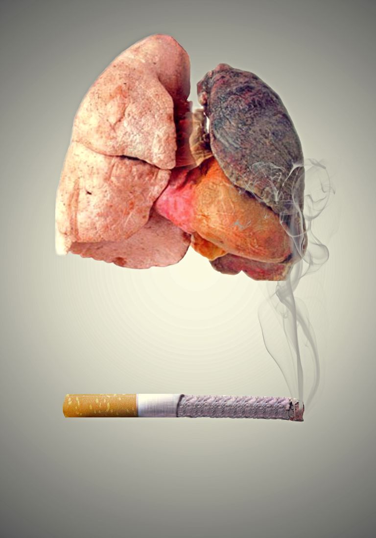 Smoker's Lungs vs. Normal Healthy Lungs