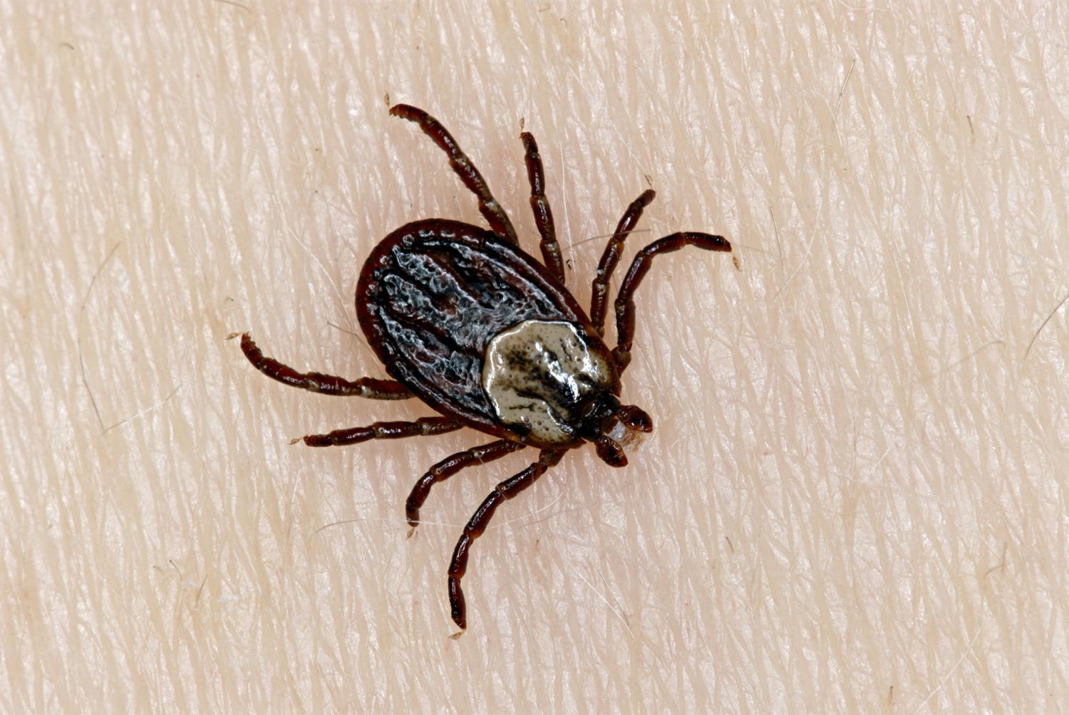 tick-removal-with-liquid-soap-real-or-urban-legend