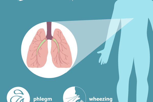 COPD Symptoms and Causes