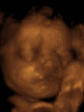 3d ultrasounds at 30 weeks