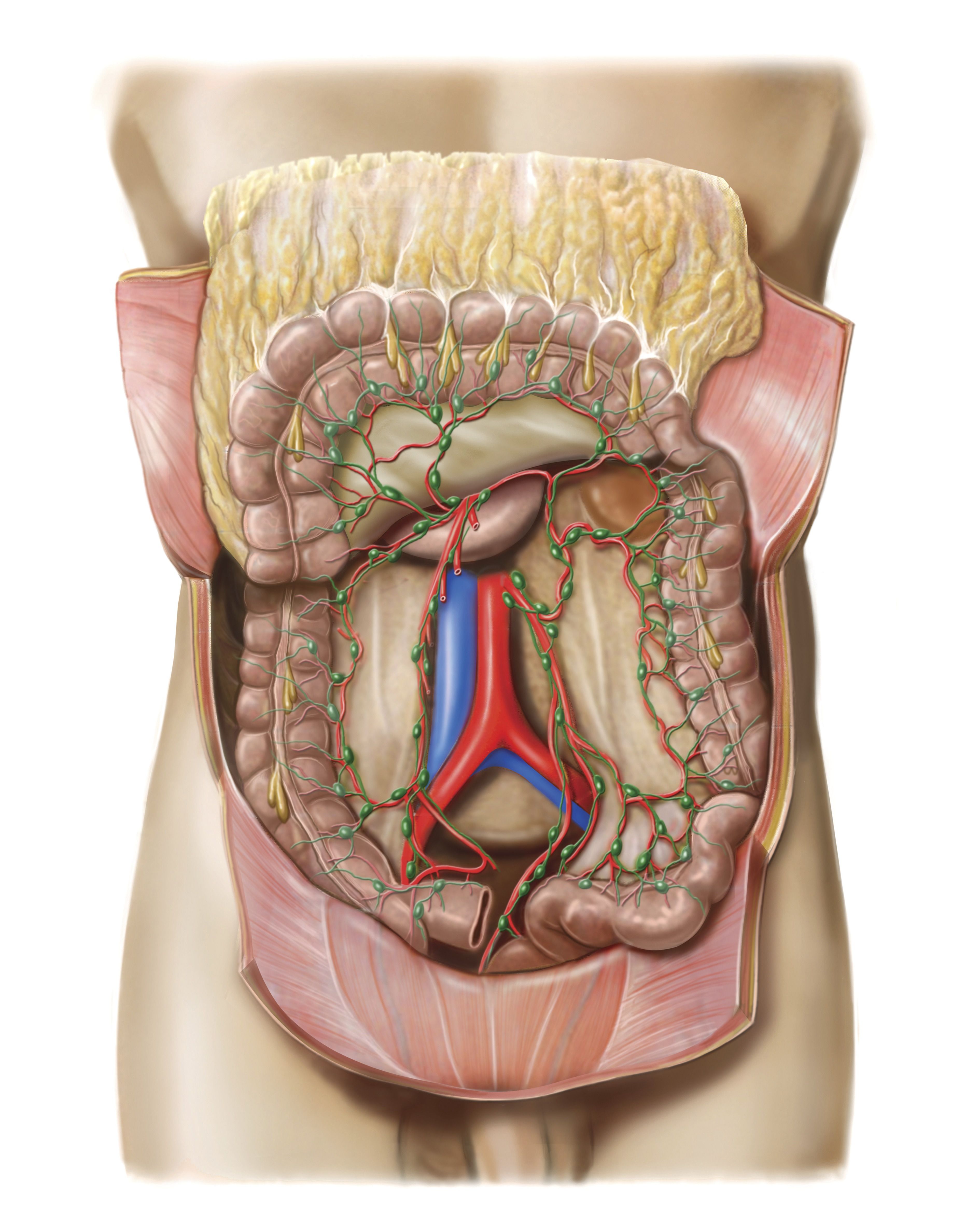 Retroperitoneal Lymp Node Dissection for Testicular Cancer