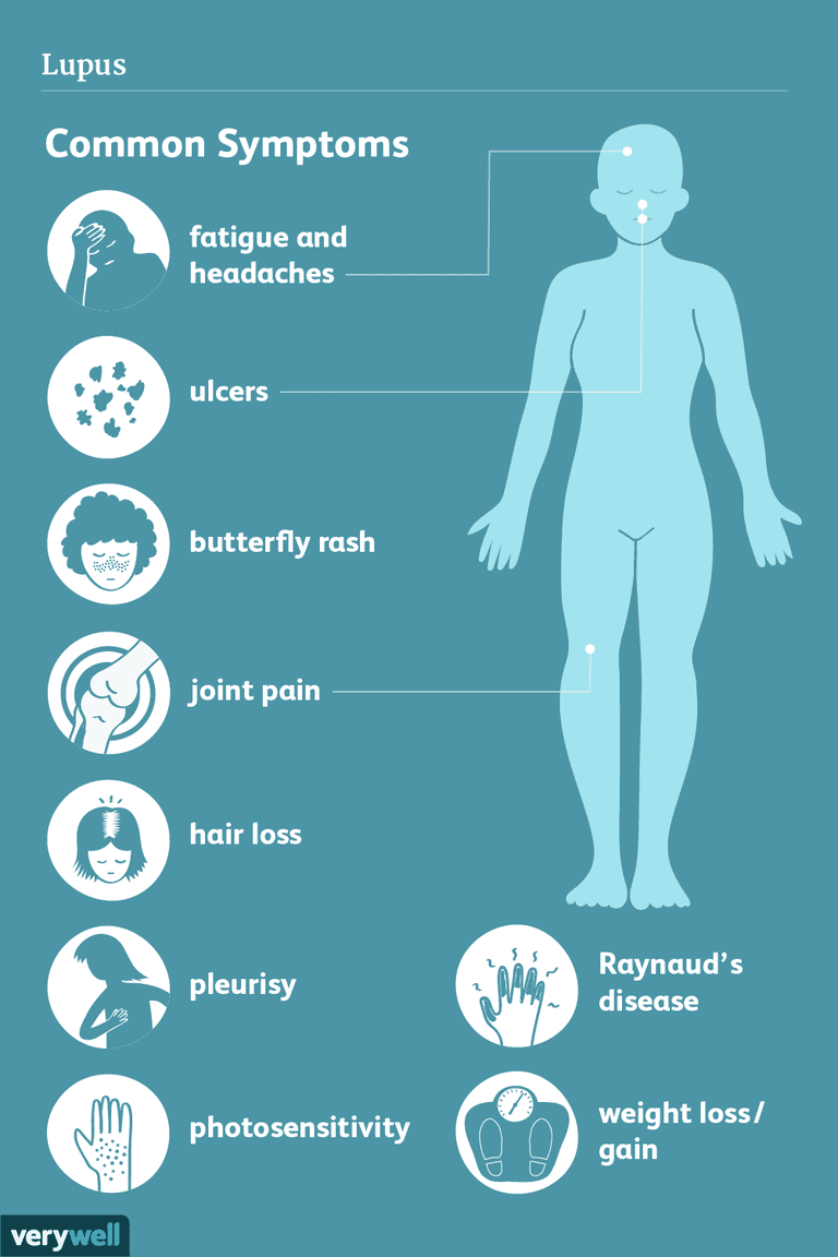 Lupus Signs Symptoms And Complications