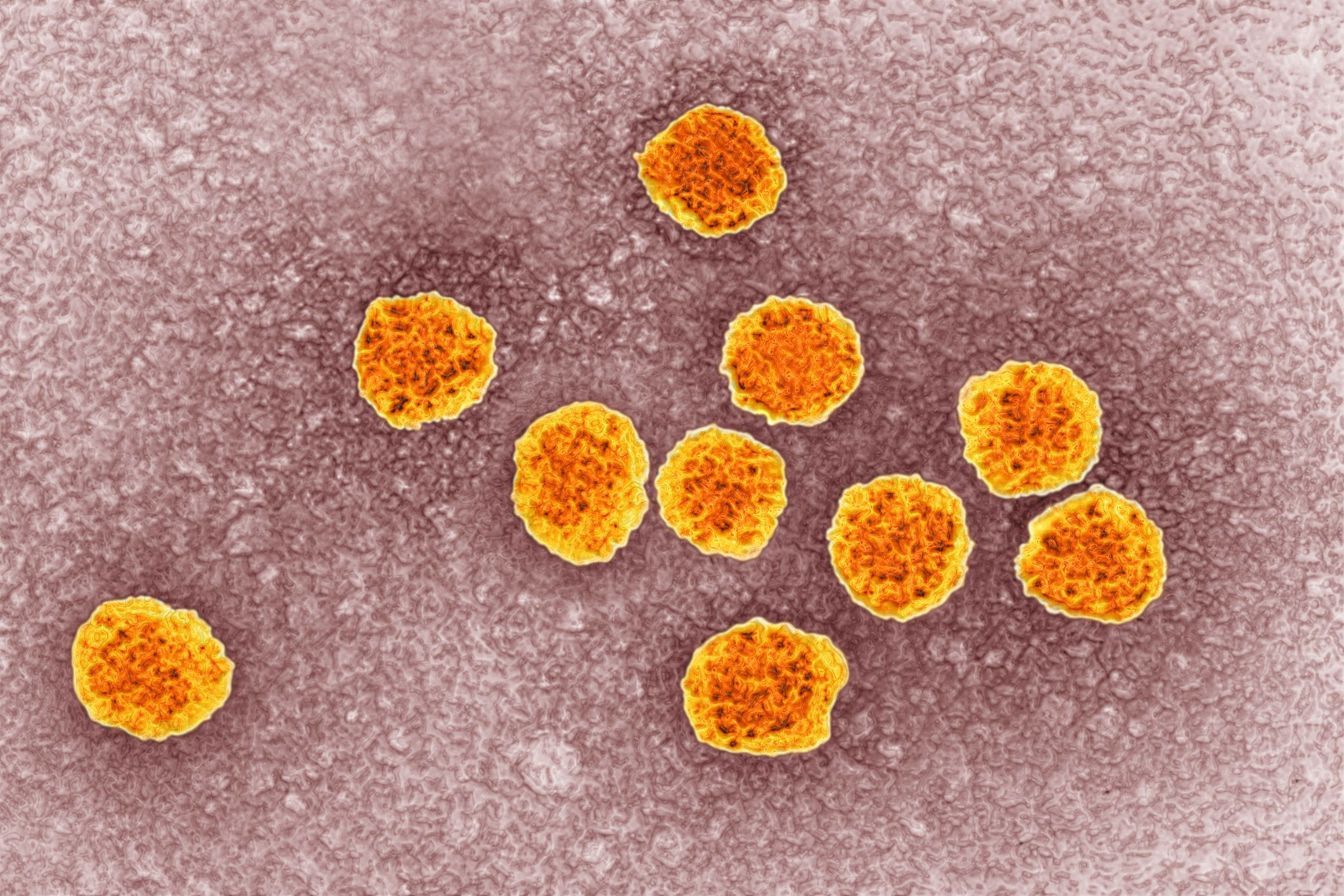 what is hepatitis c virus