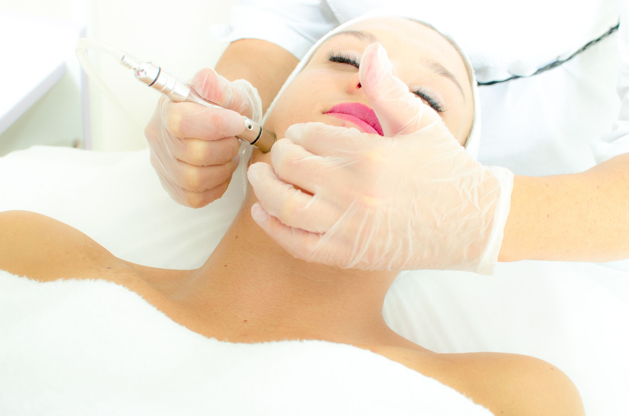 microdermabrasion-anti-aging-treatment