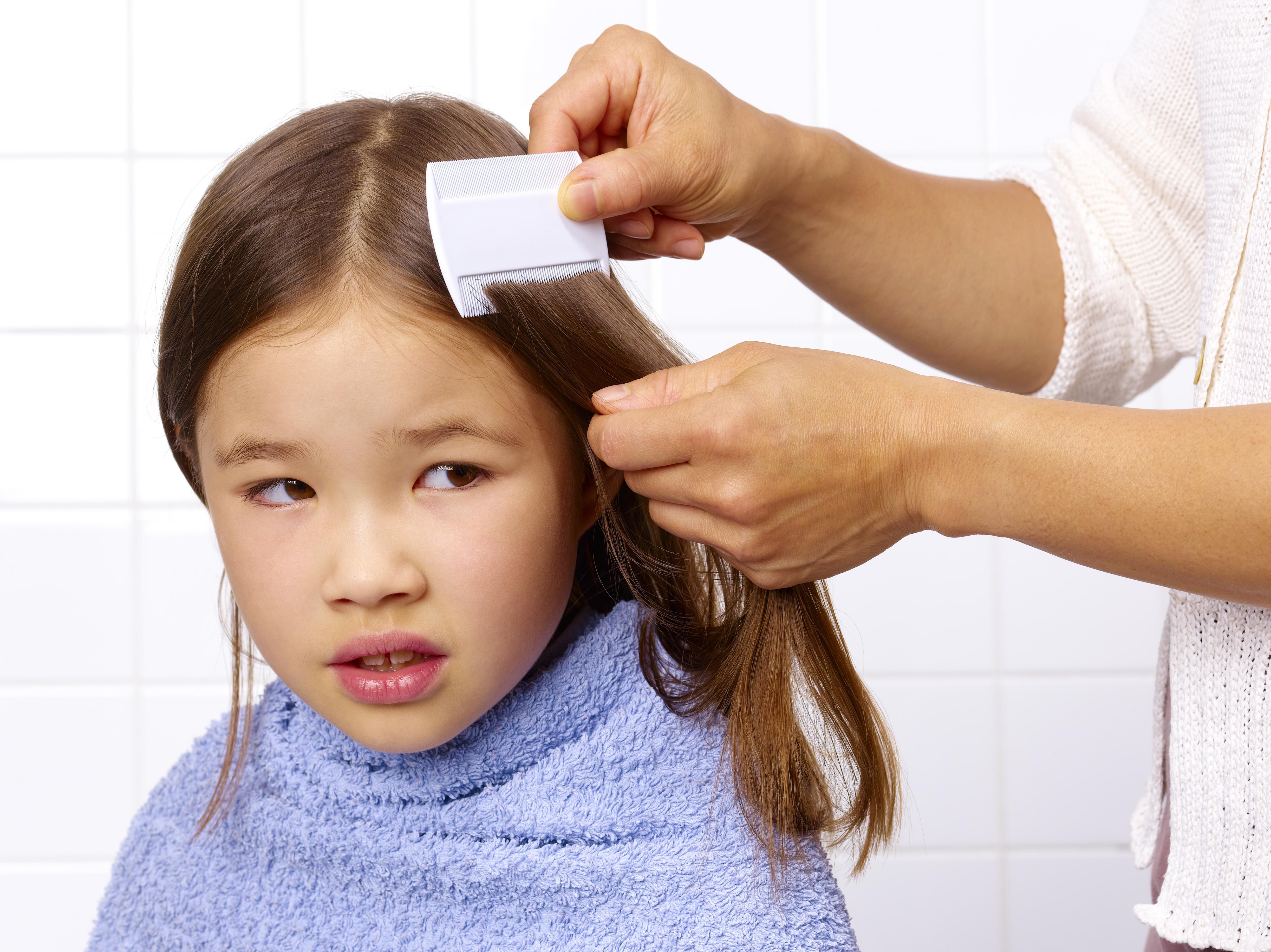 How to Check for Head Lice in Children's Hair