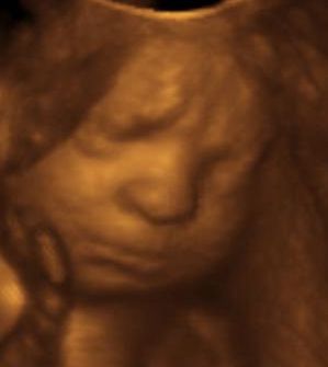 3d ultrasounds at 30 weeks