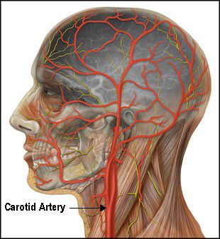 Carotid Arteries