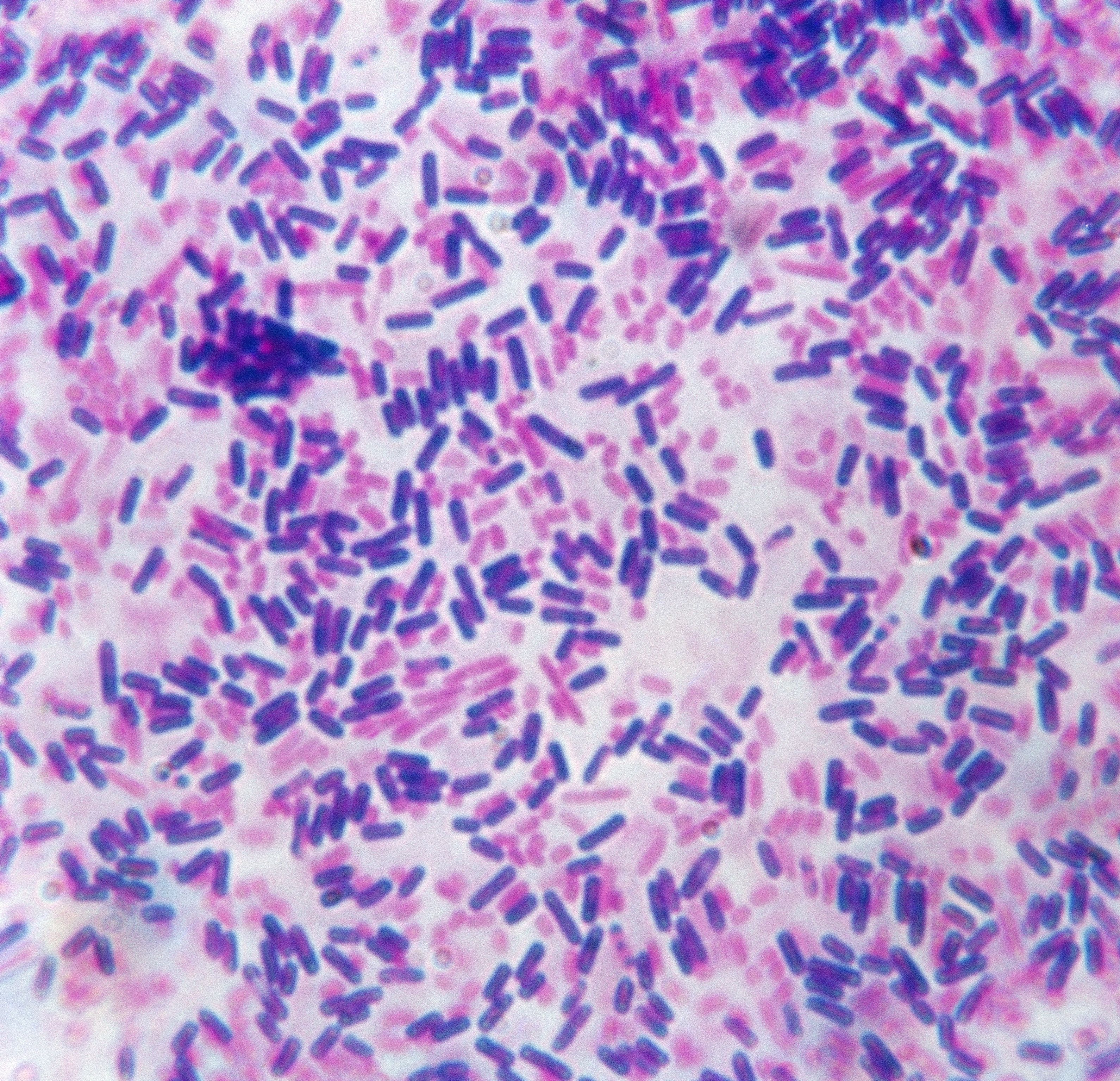 Gram Stain Procedure In Microbiology