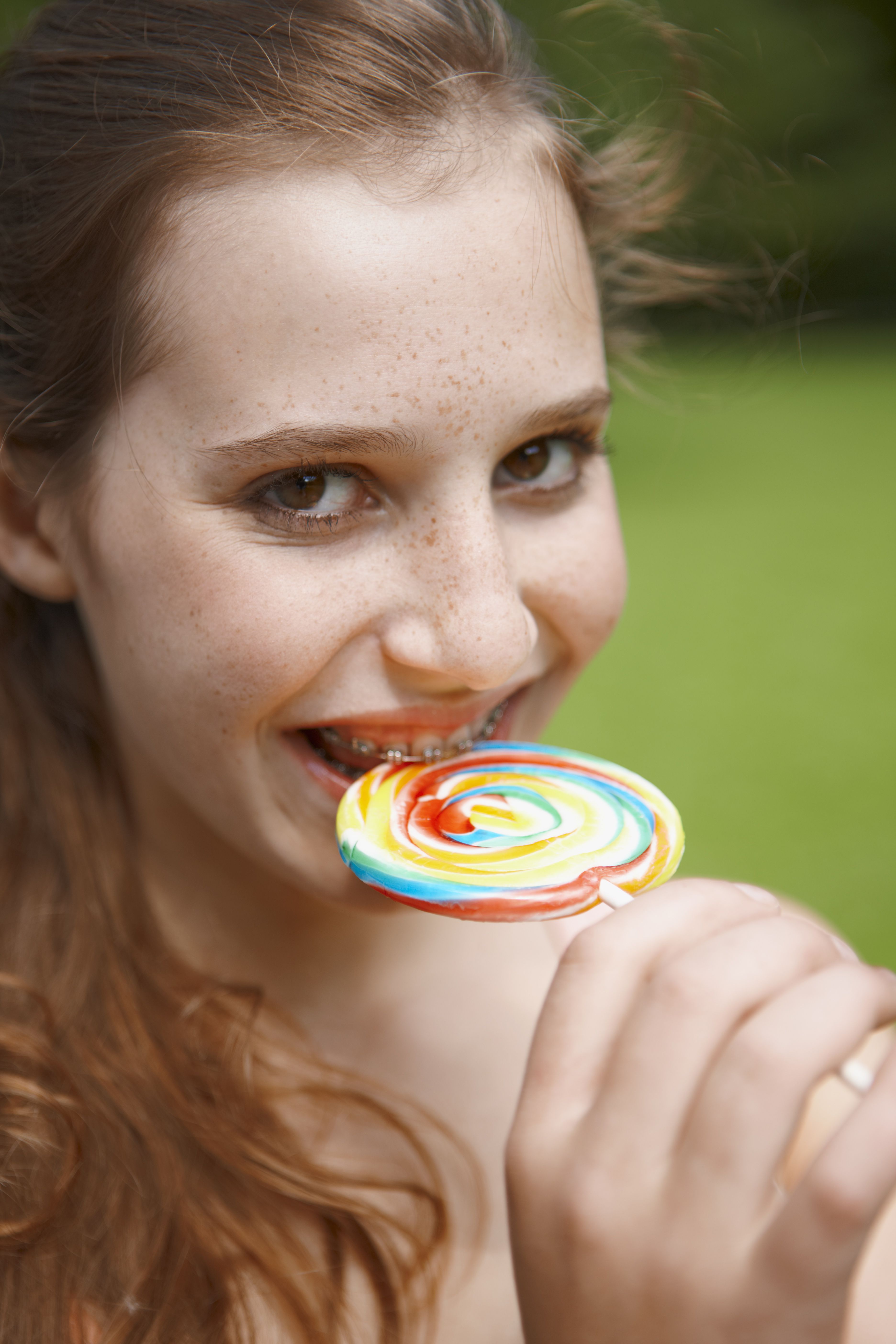 Braces and Candy: What You Can and Can't Eat