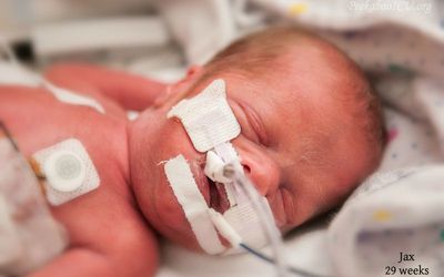 Micro Preemie Survival Rates and Health Concerns