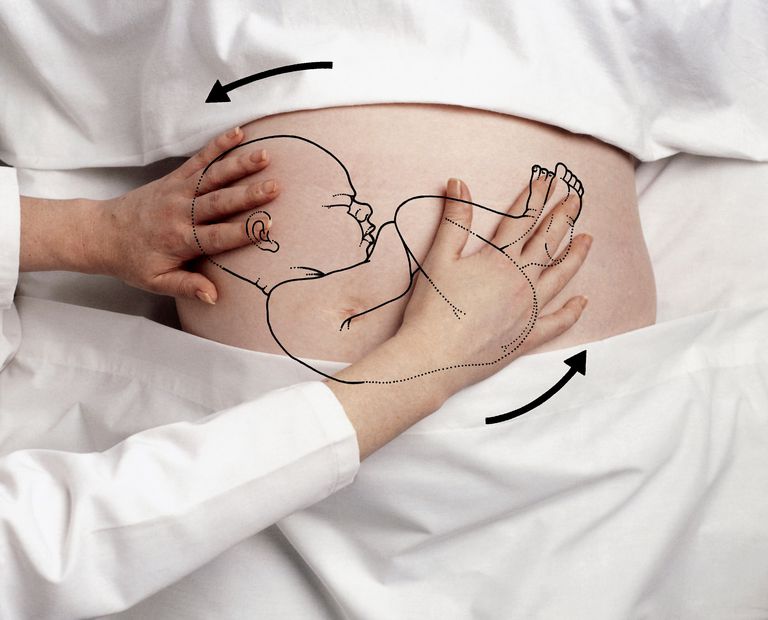 what is transverse presentation in pregnancy