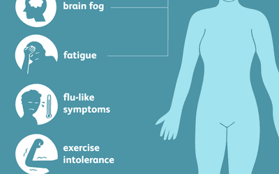 cfs symptoms