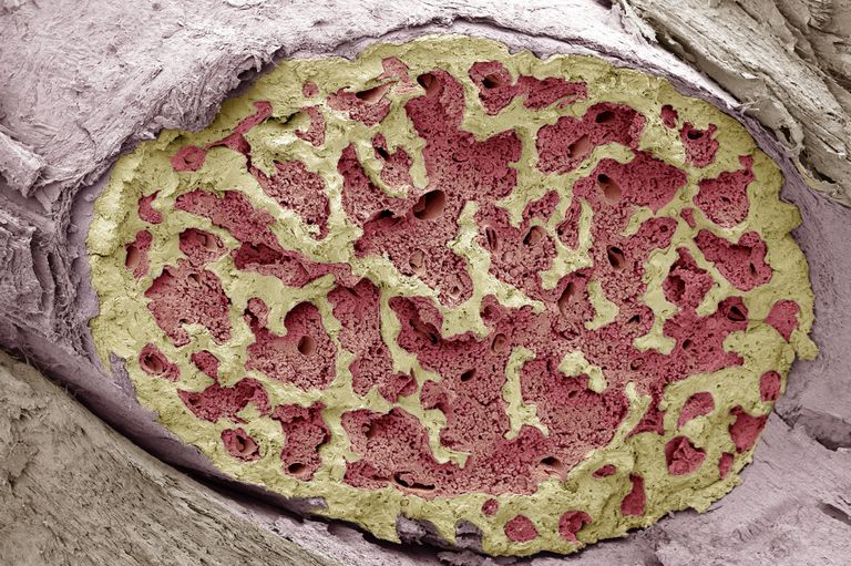 Bone Marrow - Structure, Function, Disease and More