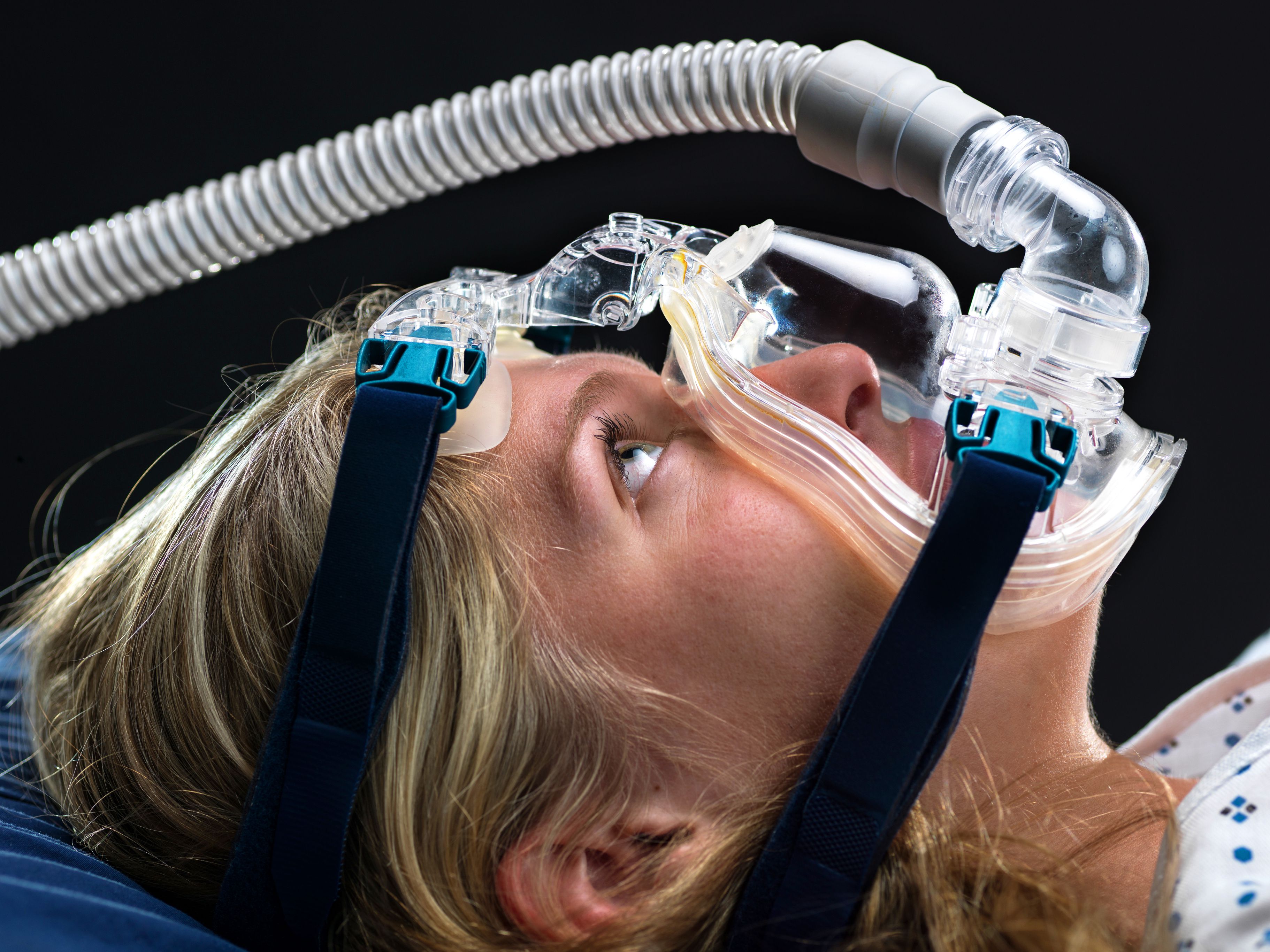 common-side-effects-of-cpap-therapy