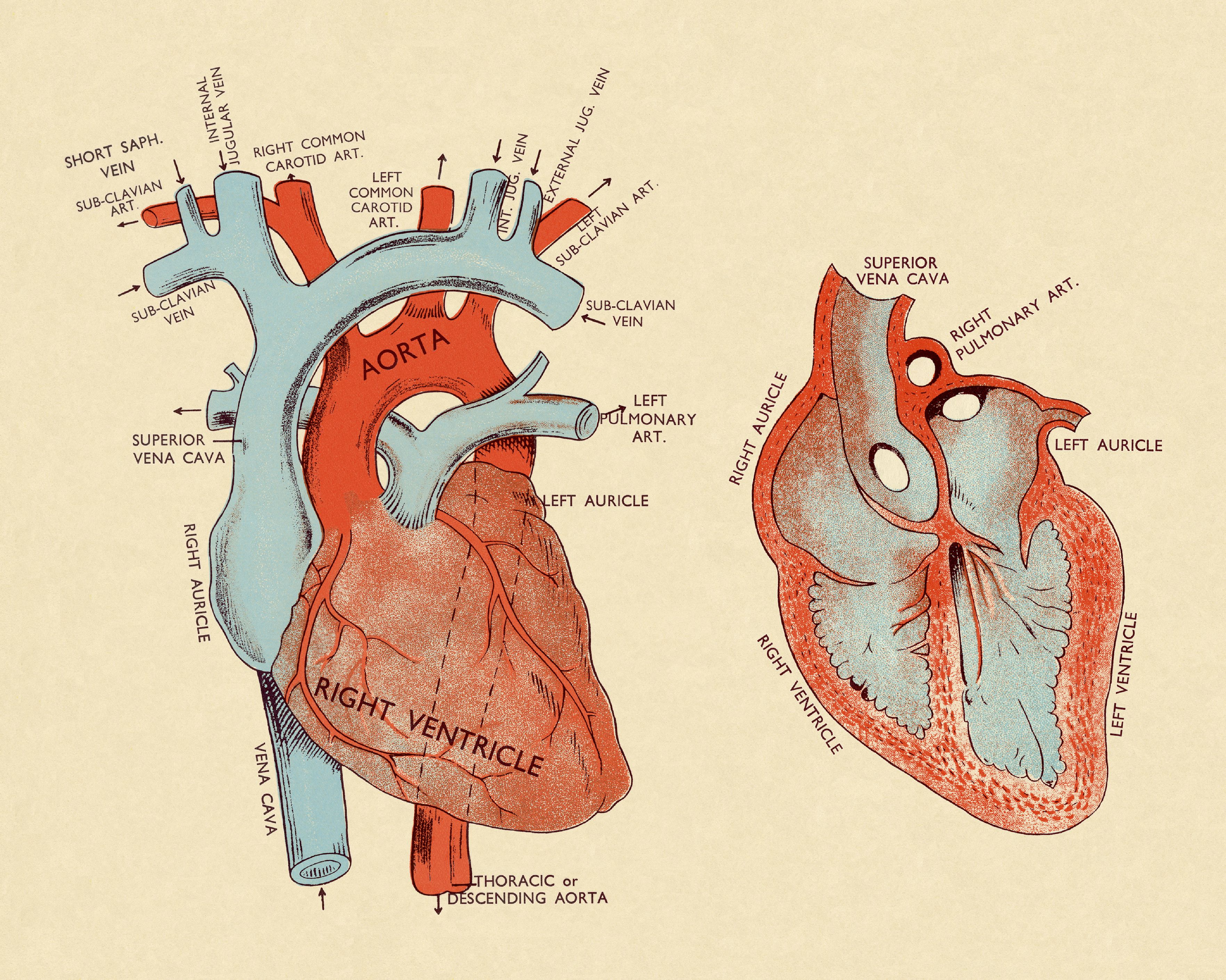 Transposition of the Great Arteries Symptoms