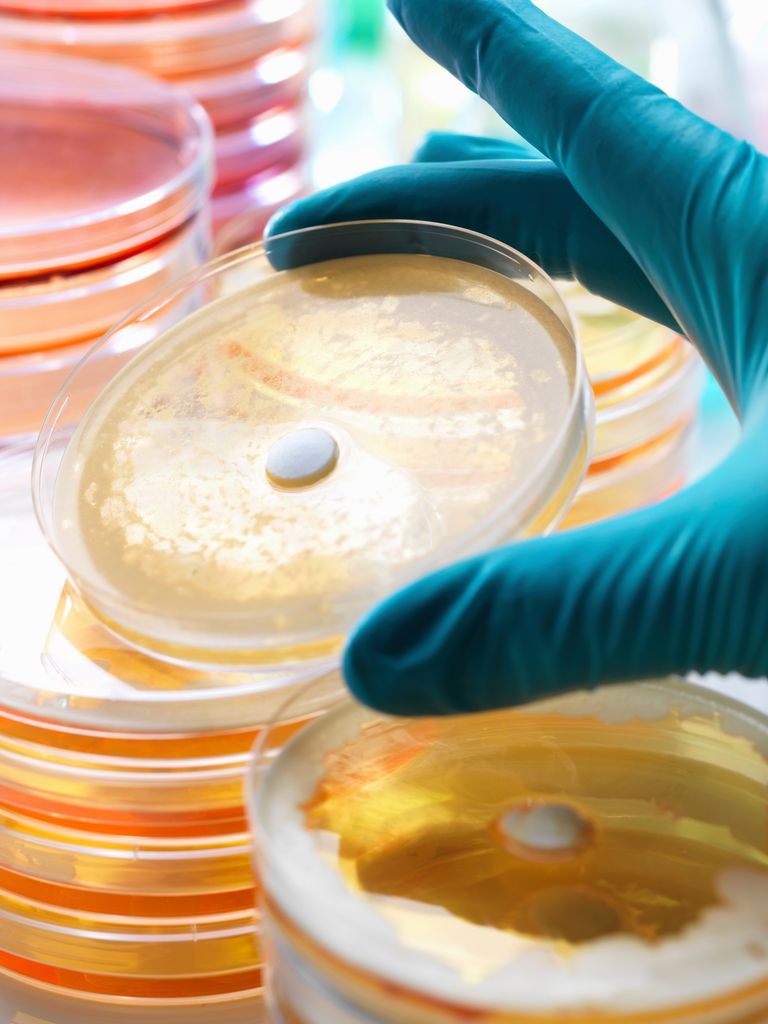 Antibiotic-Resistant Super Gonorrhea