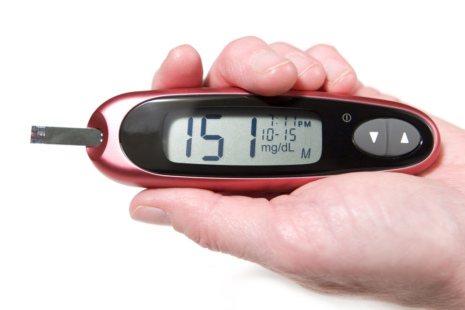 Hyperglycemia High Blood Sugar Symptoms Causes Treatments