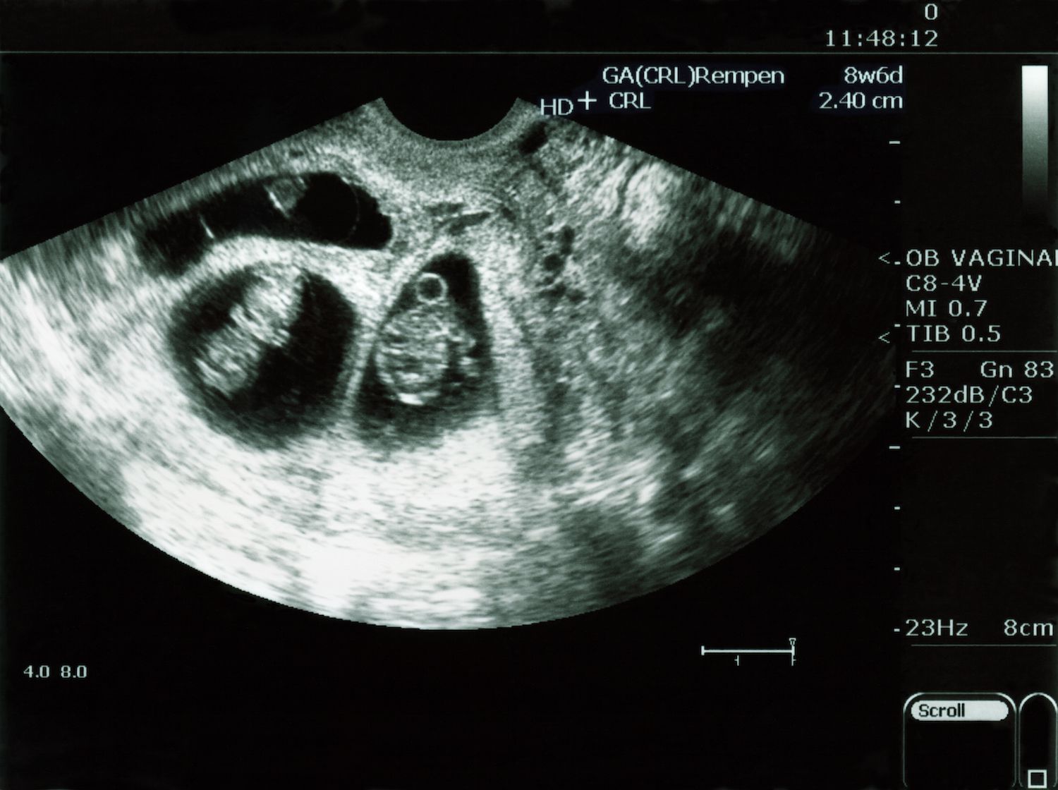 You�re Having Twins? A Guide to Twin Pregnancy