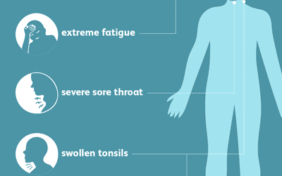 Meningitis: Signs, Symptoms and Complications