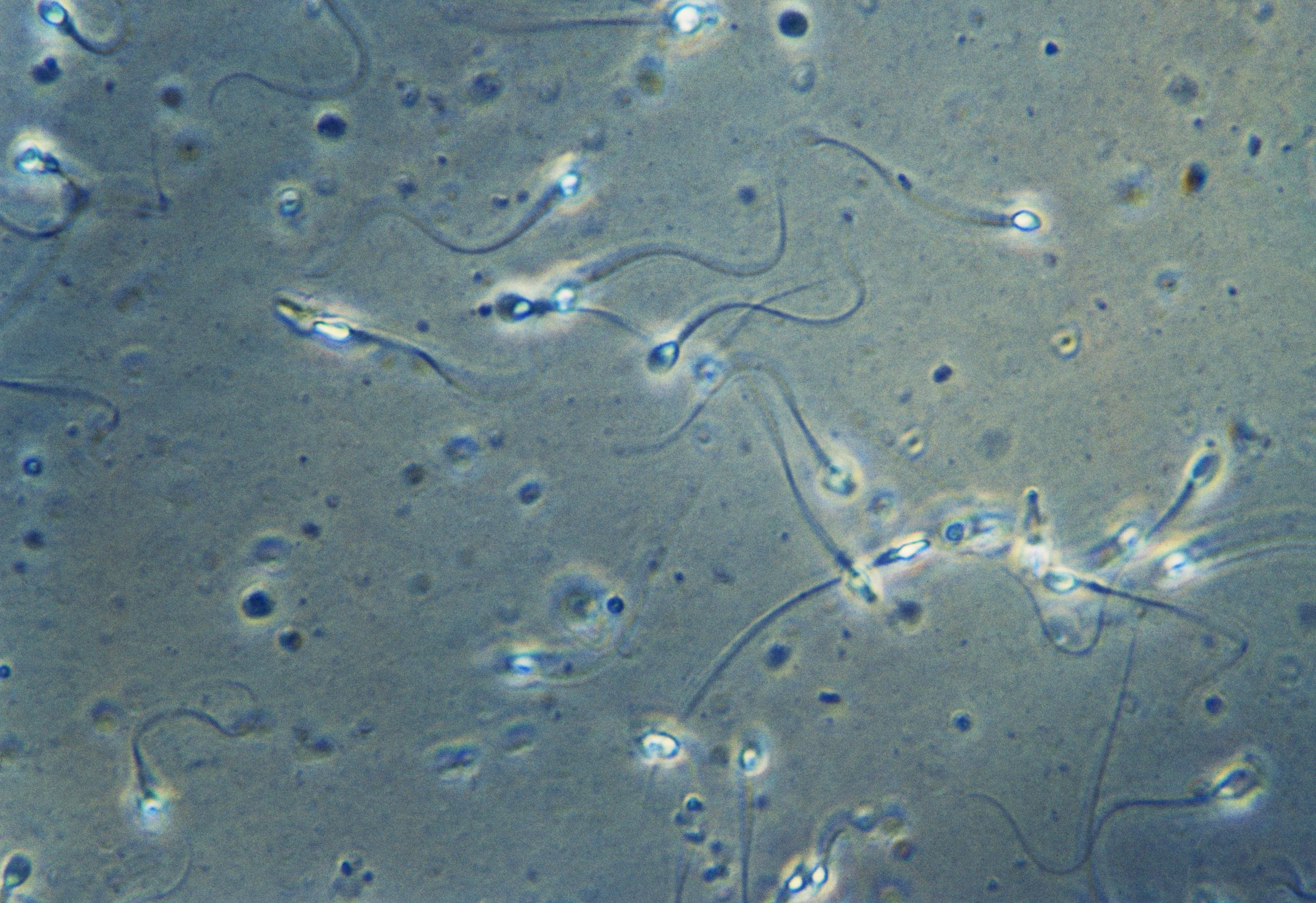 Sperm count and motility