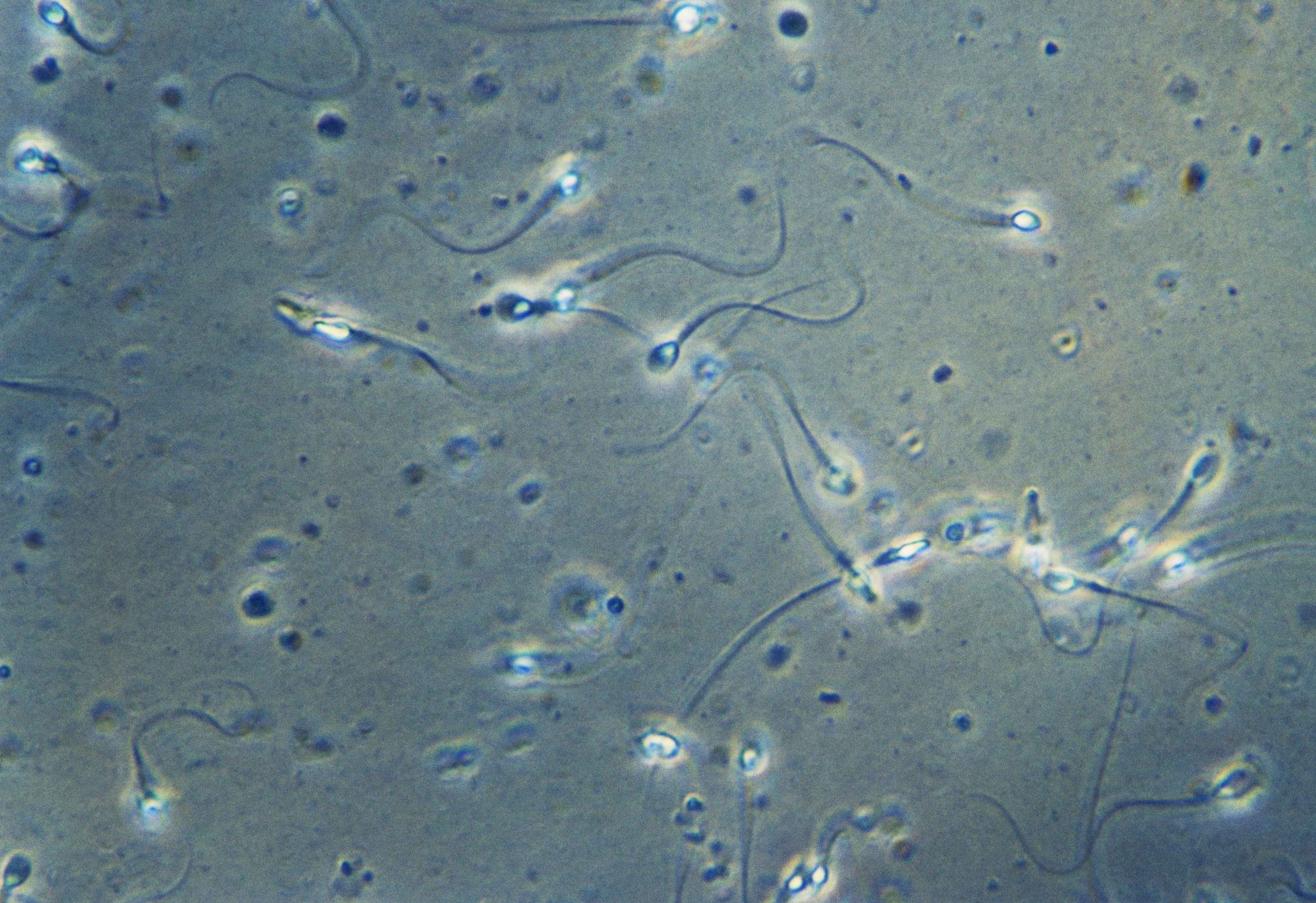 What Does Sperm Motility Mean