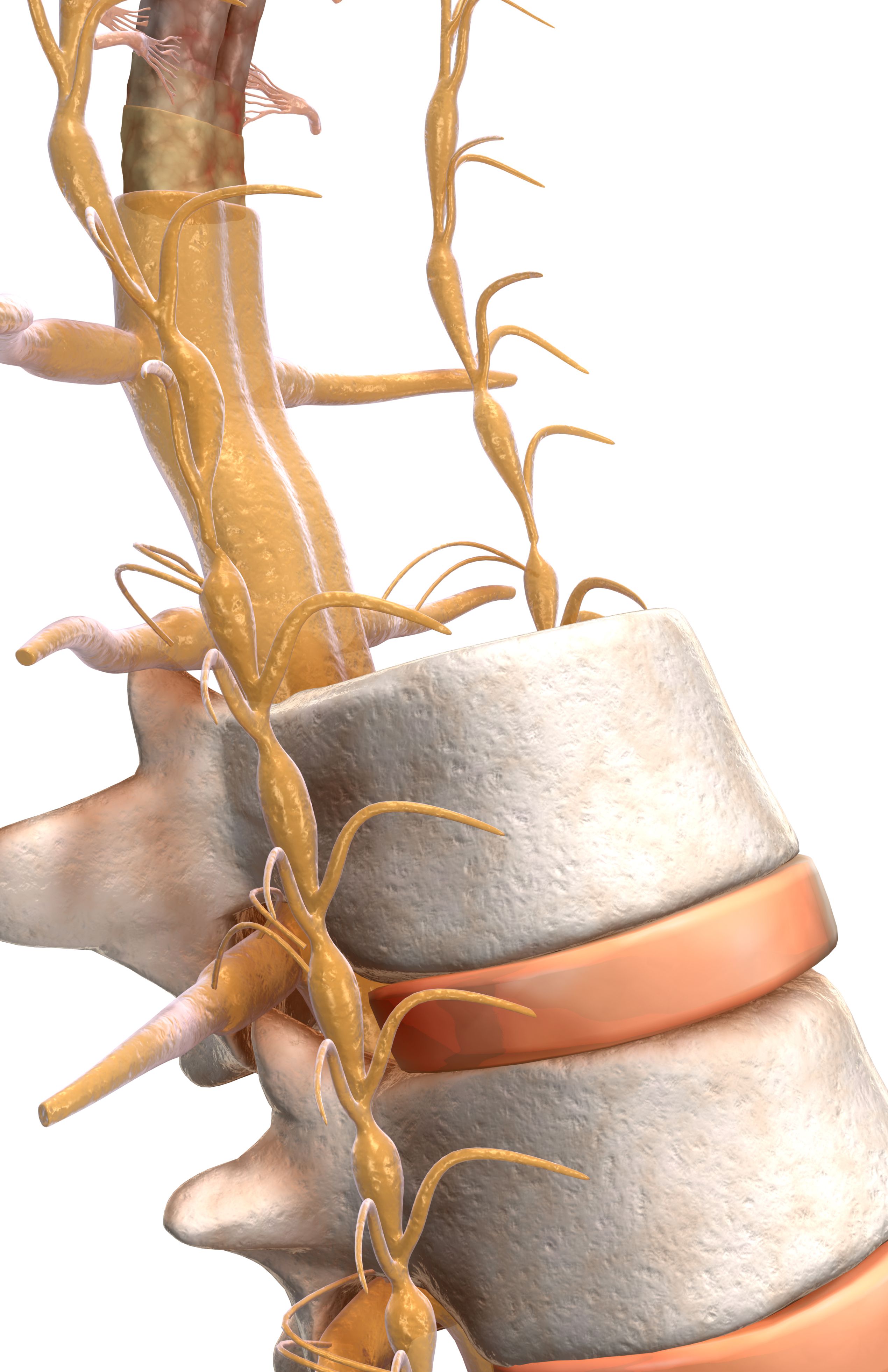 Radiculopathy, Radiculitis, And Radicular Pain