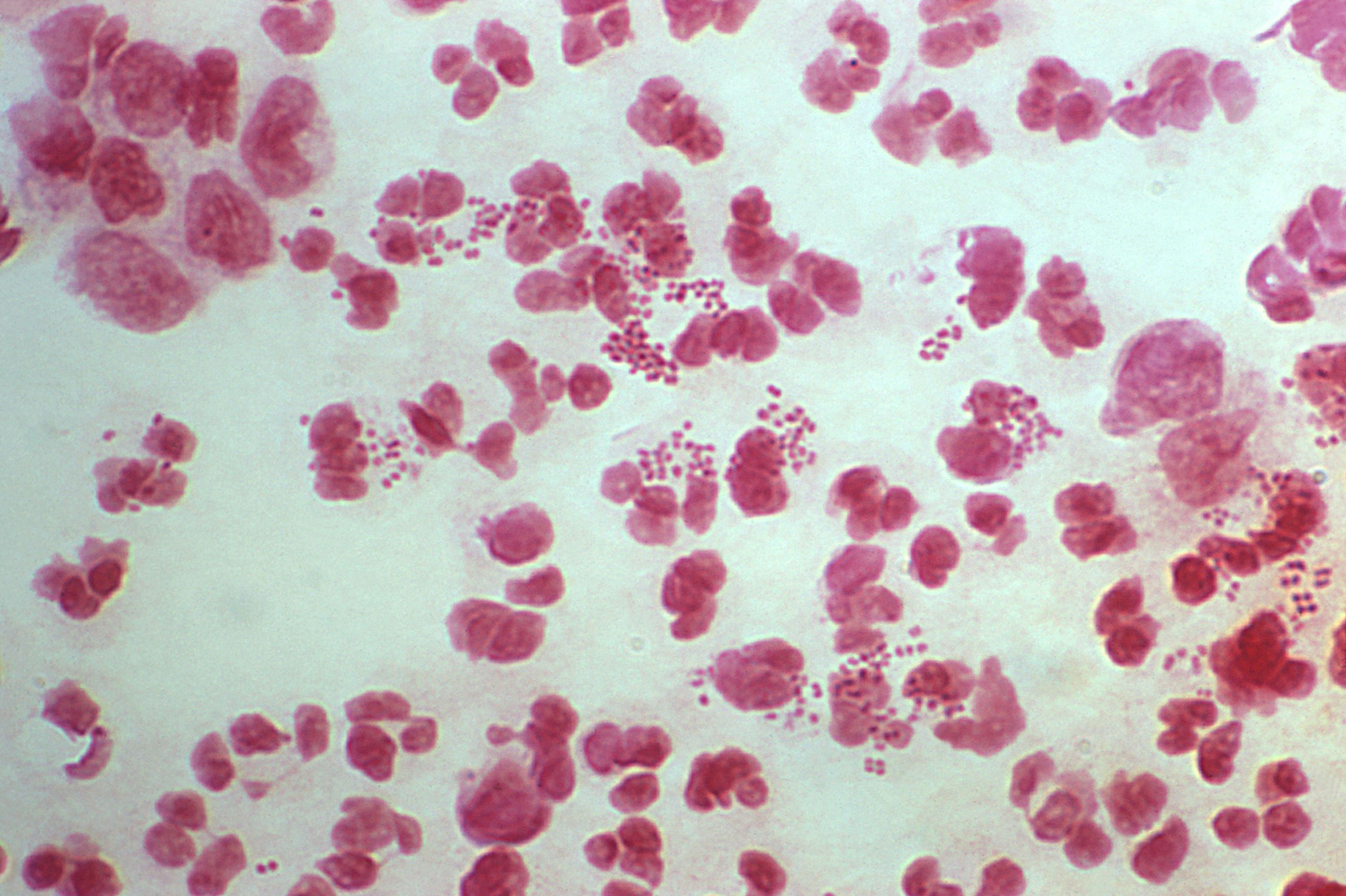 chlamydia gram negative or positive