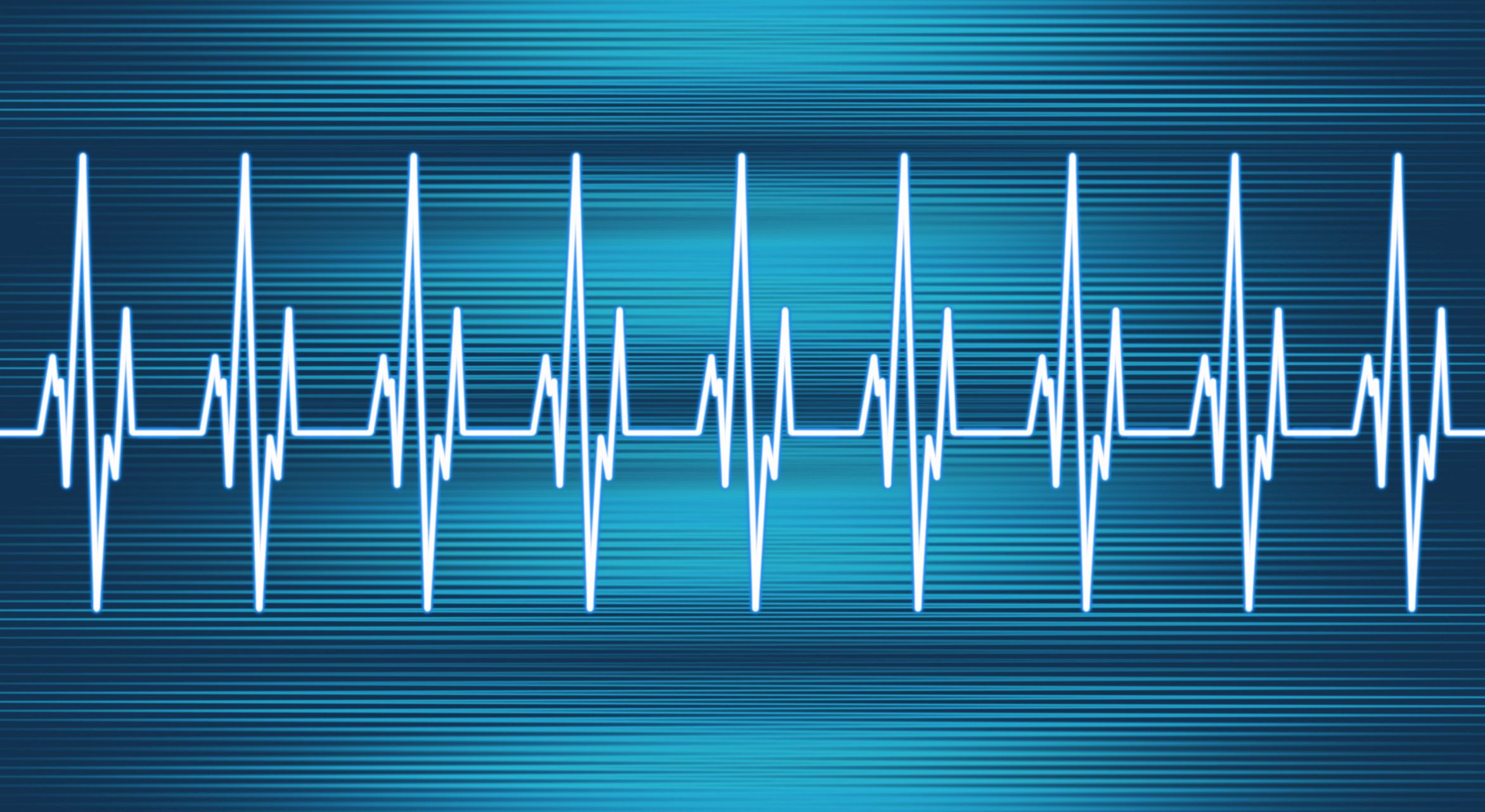 overview-of-tachycardias-and-fast-heart-rhythms