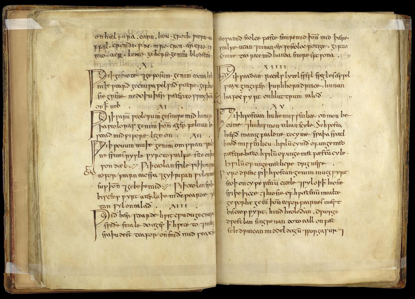 Medieval Potion Shown to Kill Problematic Bacteria