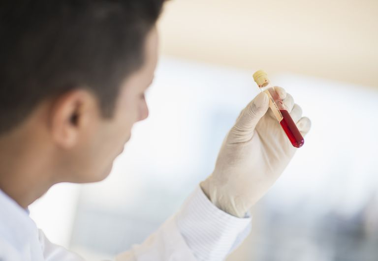 Celiac Disease Blood Tests First Step in Diagnosis