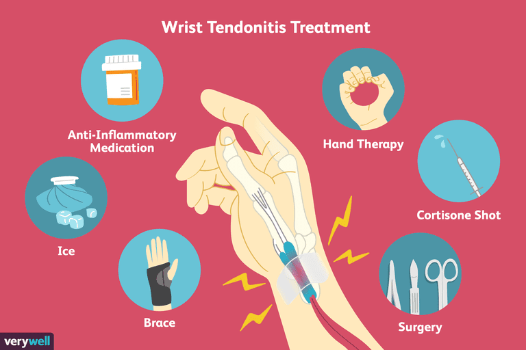Wrist Tendonitis Signs, Causes, and Treatments