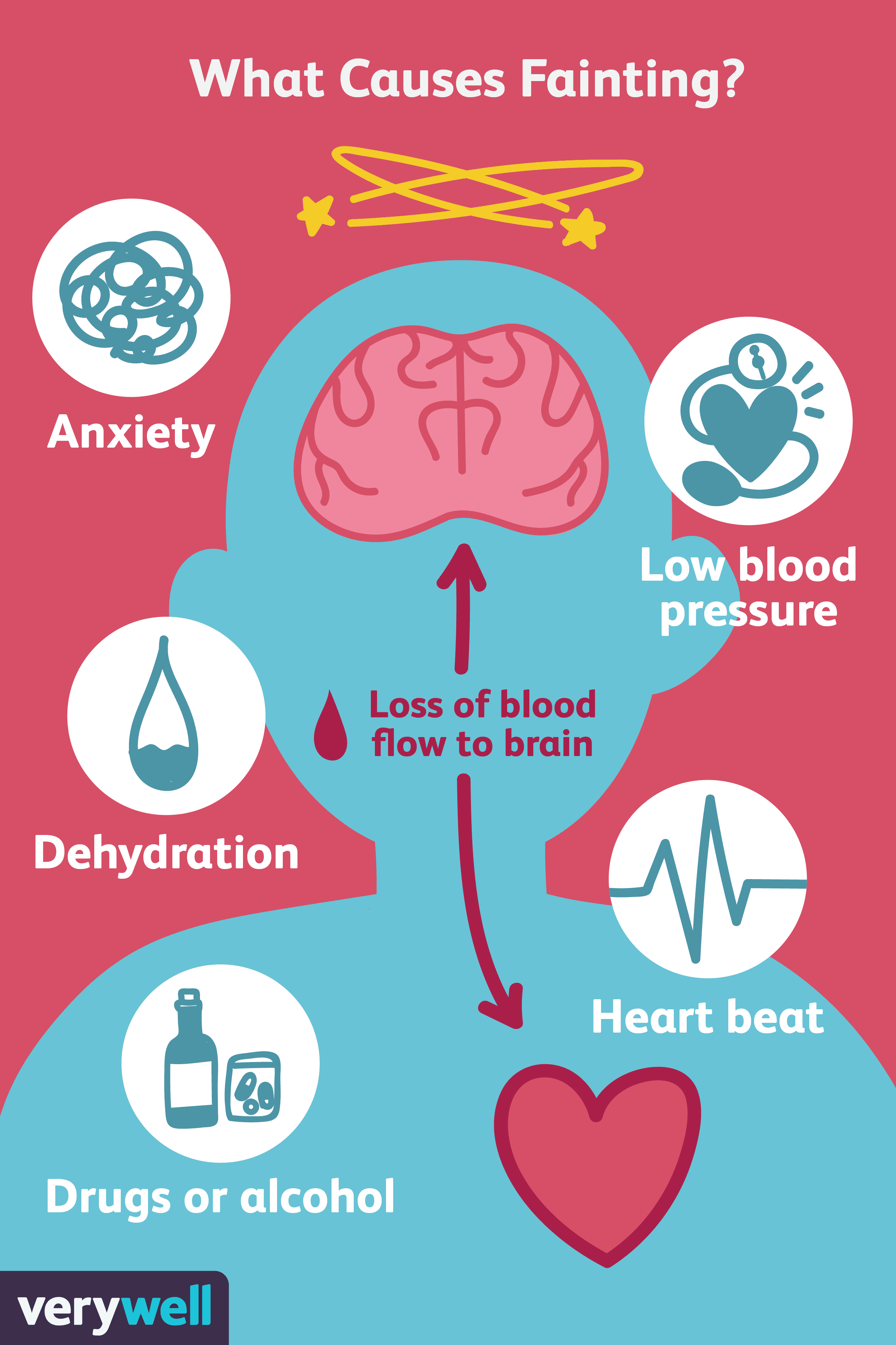 Causes Of Fainting Reasons Why We Pass Out