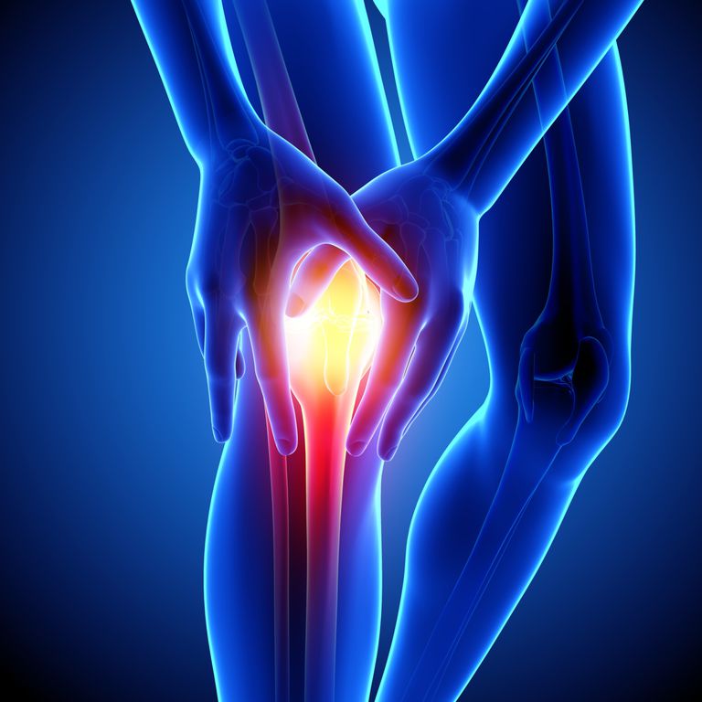 Arthrodesis or Fusion of a Joint