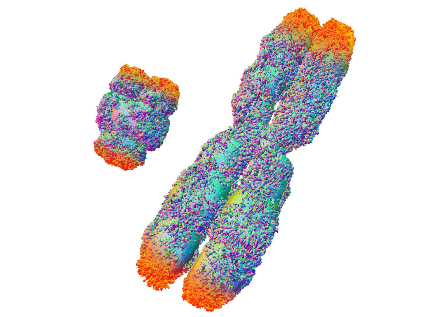 Sex Chromosome Abnormalities 1185