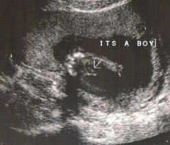 Ultrasound Images Of What Your Growing Boy Looks Like