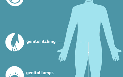 Gonorrhea: Signs, Symptoms, and Complications