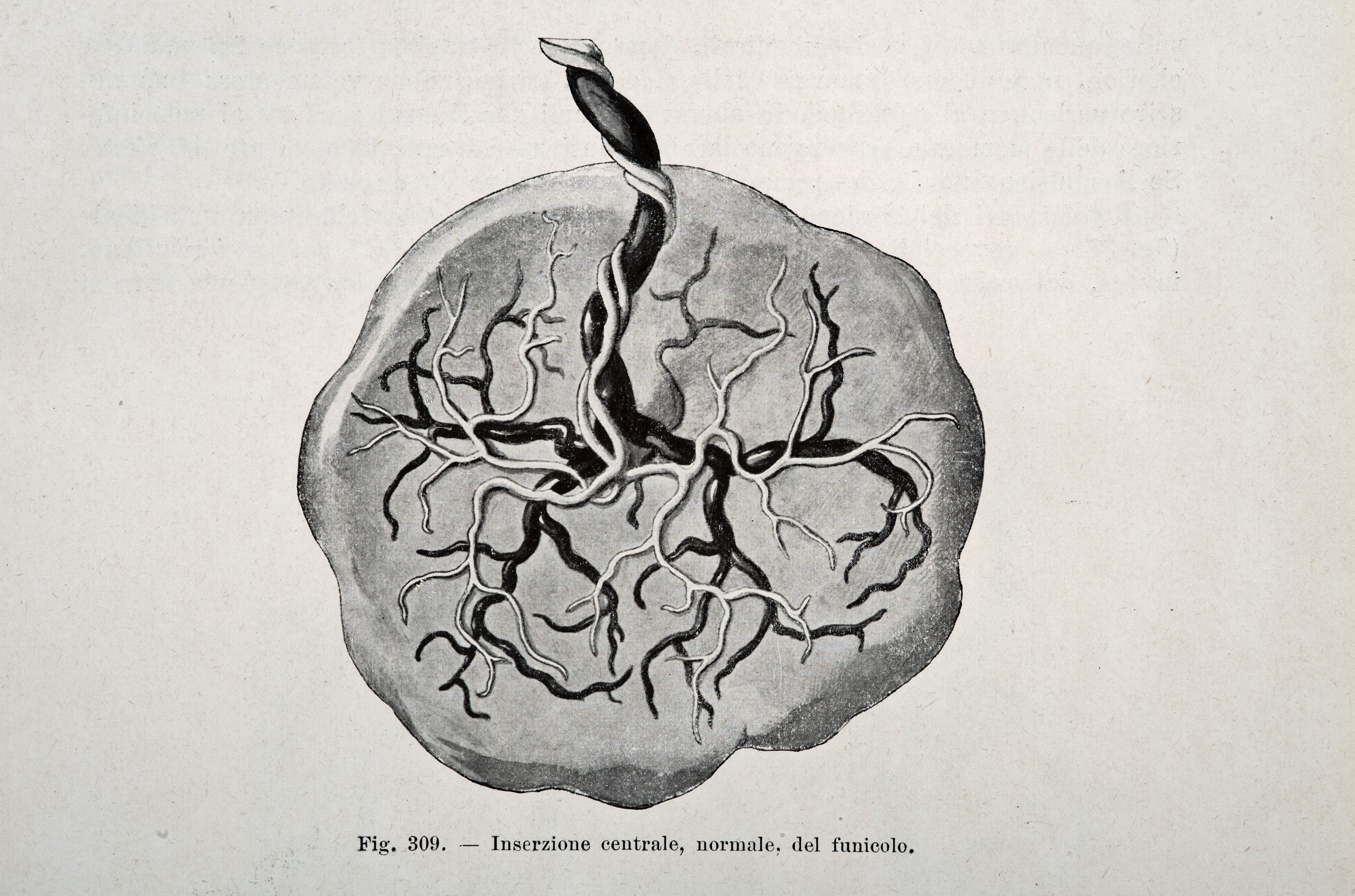 What Should I Do With a Placenta?