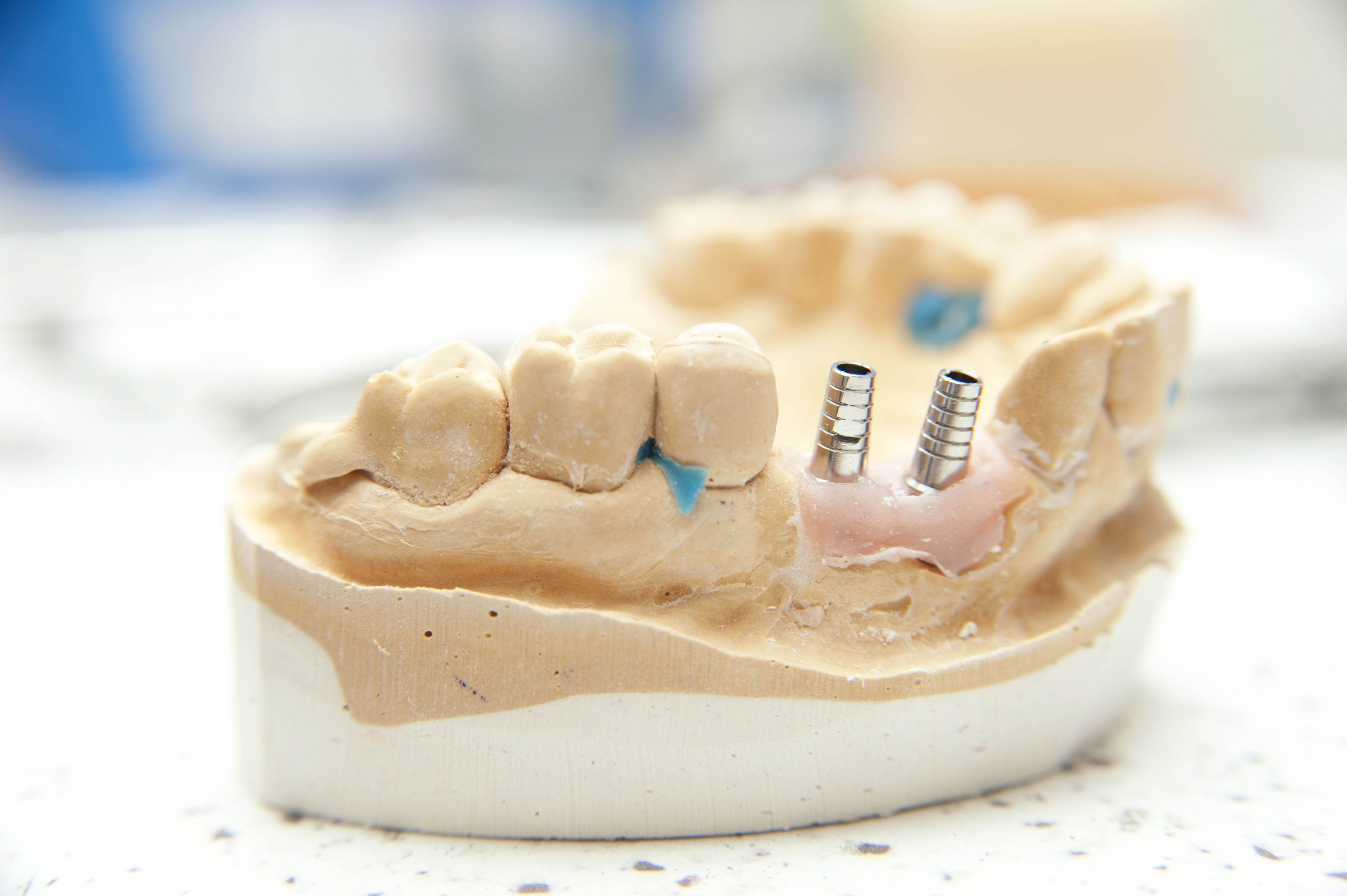 What Is Oral Surgery And How Is It Used?