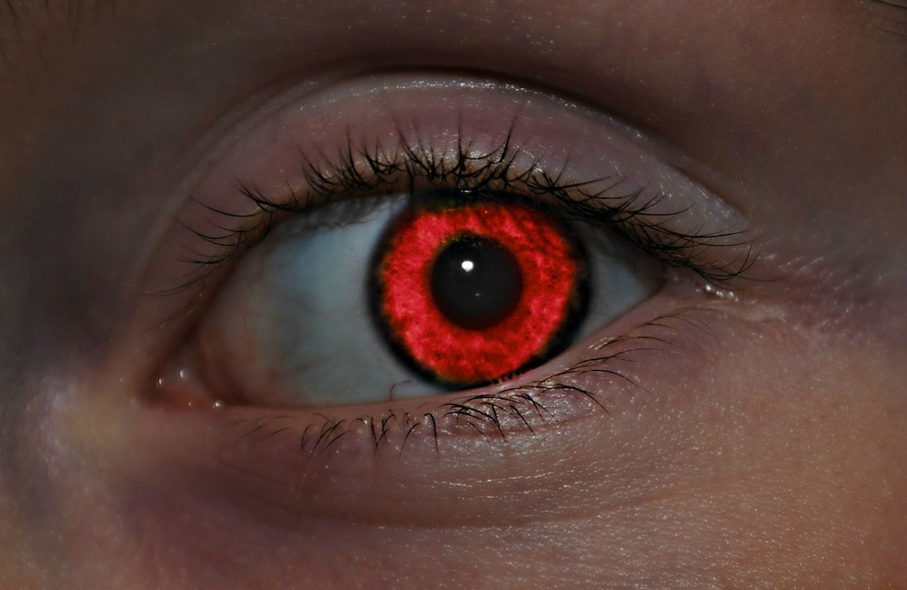 What Is Red Eye And How Can You Prevent It 