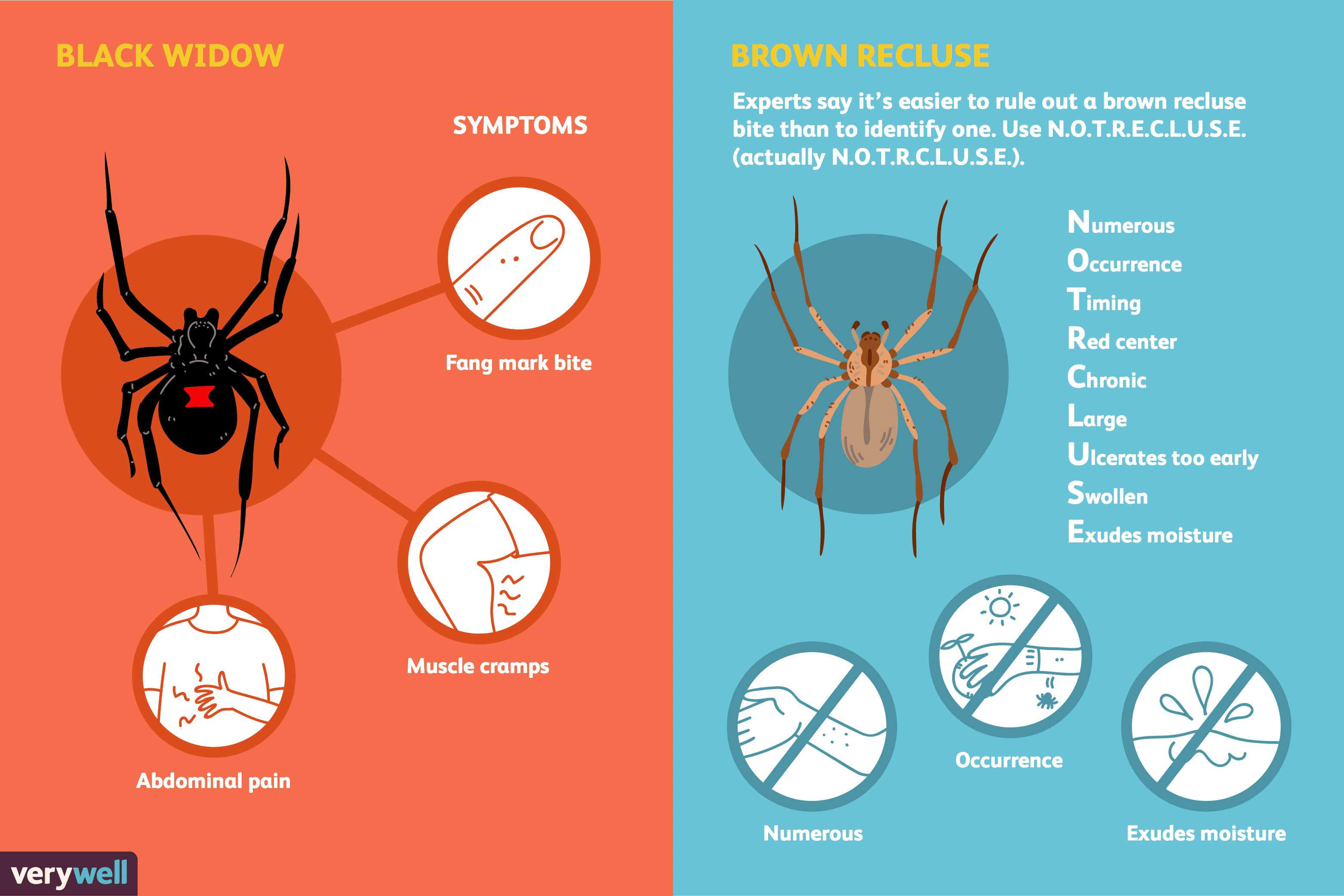 Spider Sting Symptoms at NETWARRENBLOG Blog