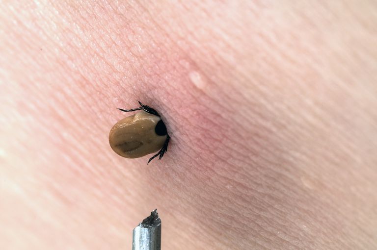 tick-bites-what-are-the-risks-how-to-avoid-them-and-what-to-do-if