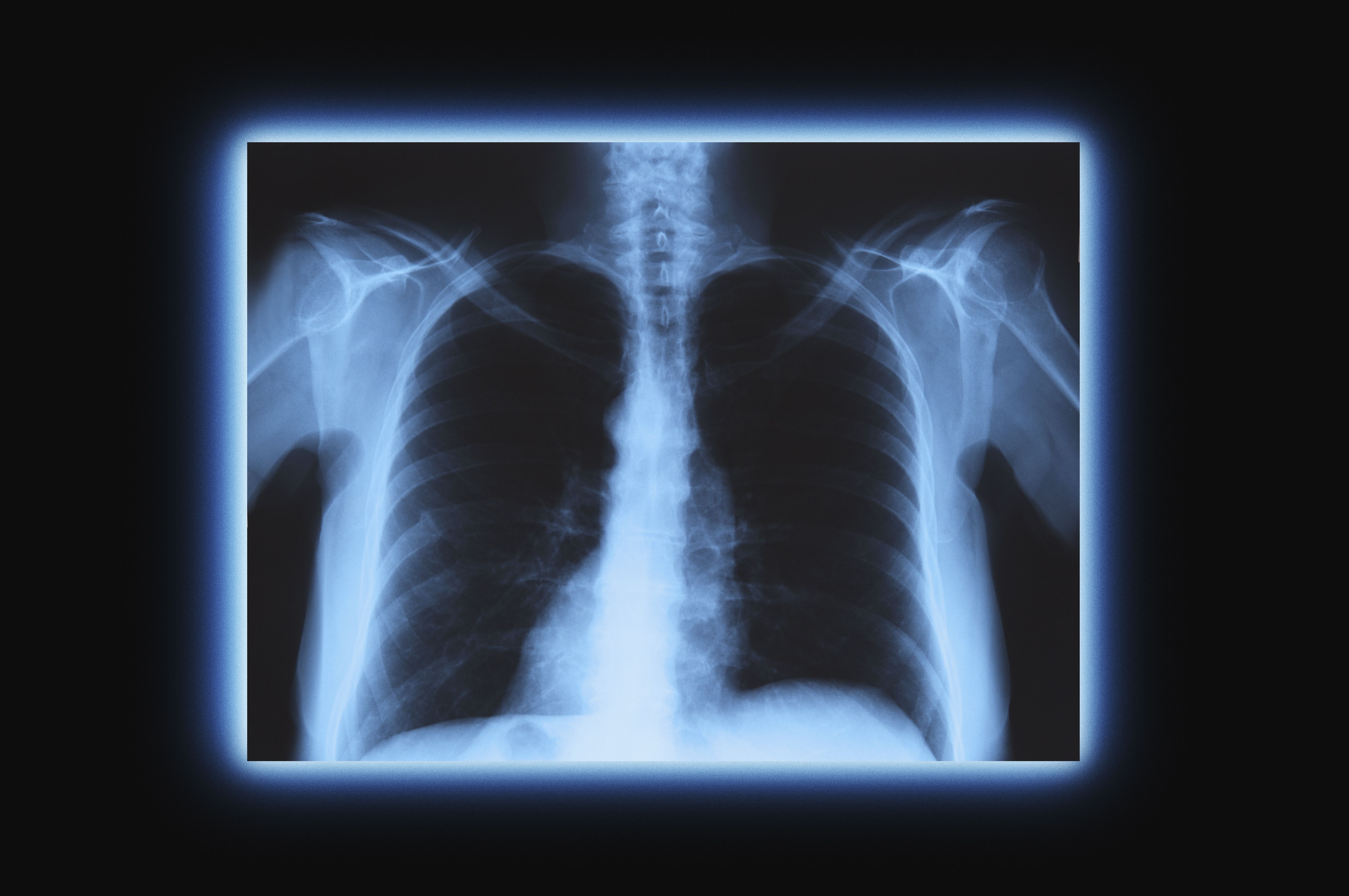 X Ray Definition and Properties (X Radiation)