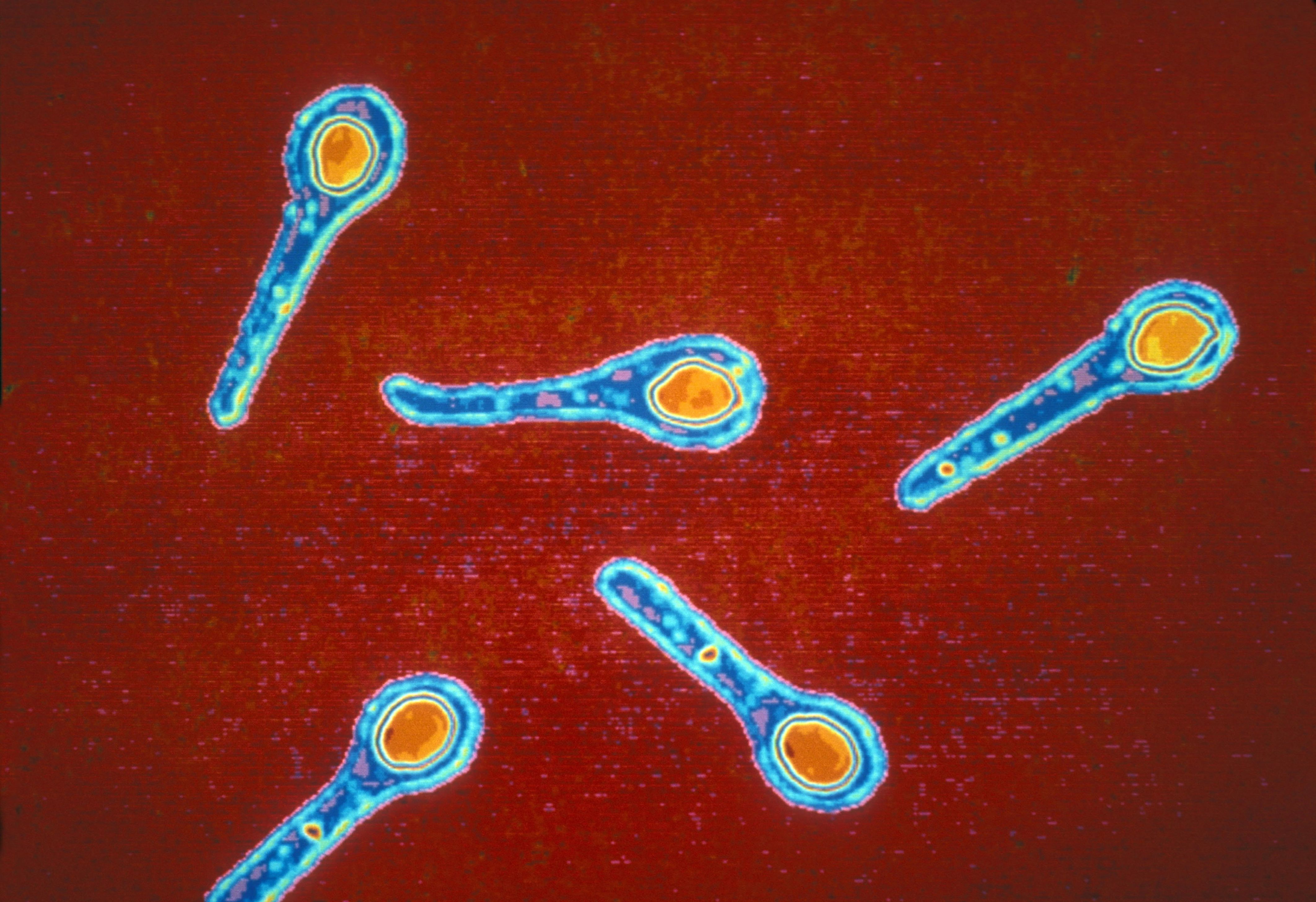 Столбняк возбудитель. Возбудитель столбняка Clostridium tetani это. Столбнячная палочка Clostridium tetani. Бактерией Clostridium tetani.