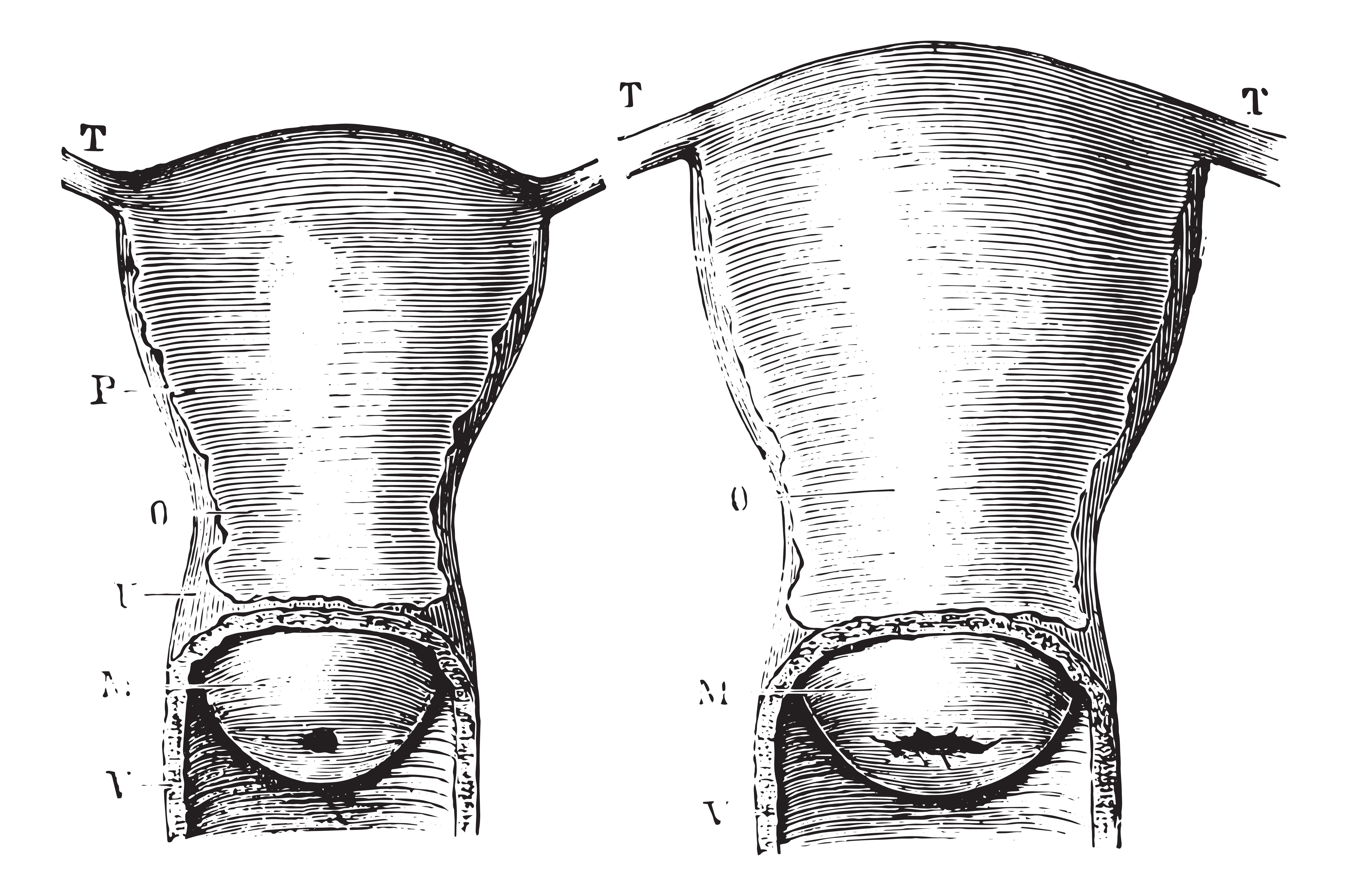 What Does A Fertile Cervix Look And Feel Like-3822