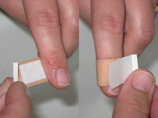 first-aid-101-how-to-treat-cut-fingers