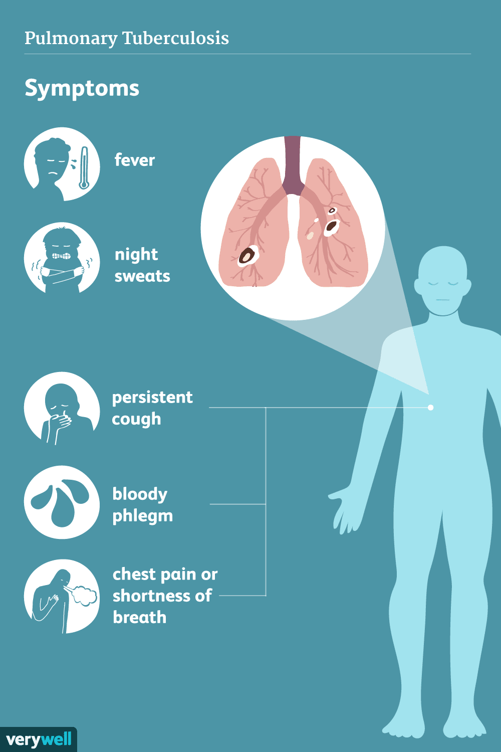 tuberculosis cause symptoms and treatment